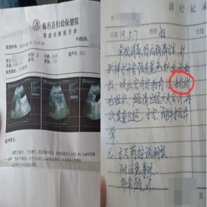 德州一女子未孕却被查出怀孕，手术后医院也“傻了”
