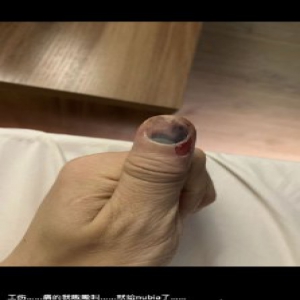 陈奕天手因工作受伤惹粉丝担忧 还好陈奕天多才多艺