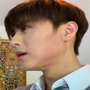 王子邱胜翊晒“挨打”自拍粉丝直呼心痛