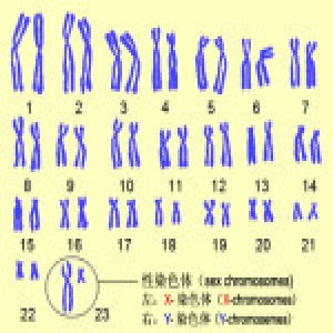 15岁女孩比同龄人矮一个头 原因其实是少了条染色体