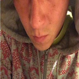36岁的陈冠希老成这样？尖嘴猴腮满脸黑斑(图)