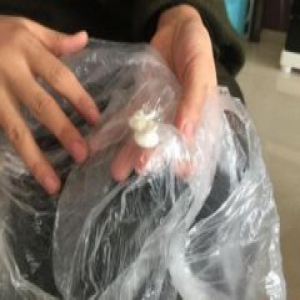 安徽一4岁女童称下身被女教师塞棉花 监控看不清