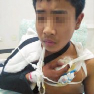 男生在学校被同学砍断5根手筋 校长：等法院判决