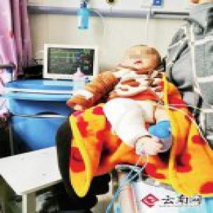 新买热水袋充电时竟然炸裂！烫伤3个月大宝宝
