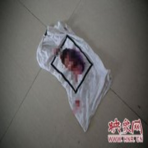 17岁男孩被困传销组织 寄回带血图片向家人求救