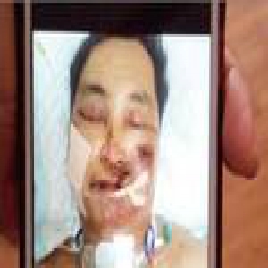 肇事人逃逸躲大坝三天不吃不喝 始终未出伤者治疗费