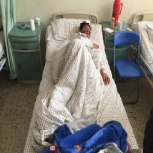 男孩因“没洗脸”被寝室长泼开水 事后抹盐毁容