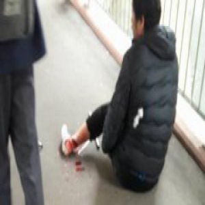 内地男在港遭外籍匪徒斩断脚筋 场面血腥