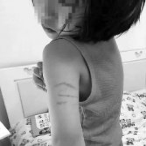 曝幼儿园老师打骂女童 园方：图片不真实感觉被讹诈