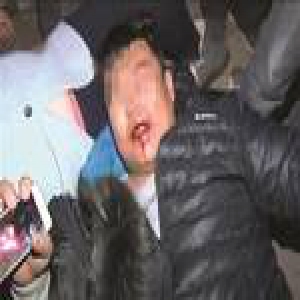 男子闪了两下远光灯被数人围殴 同行女子被打昏迷