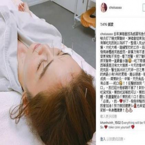 心疼！阿Sa积病5年声带严重水肿 满脸插针治疗