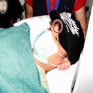 刘德华除盆骨受伤脊骨也受伤 靠止痛药镇痛