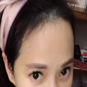 产后严重脱发的伊能静，如今头上成了这样