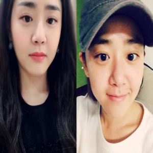 心疼！文根英公演取消 右臂准备第四次开刀