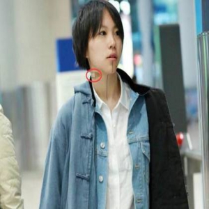 窦靖童与周冬雨同行 脖子上创可贴抢镜