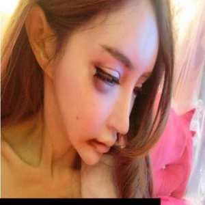 “第一网红”自曝被男友家暴：假胸几乎爆炸