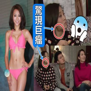 前港姐颈部惊现巨瘤！随剧集播出越长越大(图)