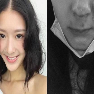 23岁甜美女星严重车祸破相断鼻：幸好我没死