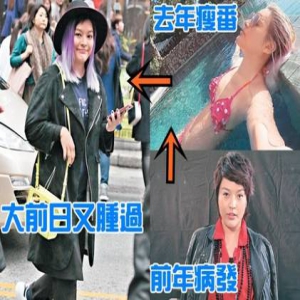 时胖时瘦！叶佩雯疑似甲状腺荷尔蒙分泌失调