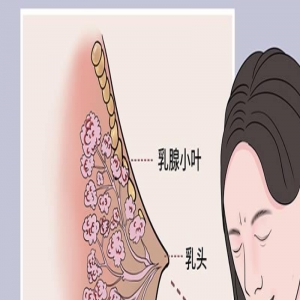 乳腺保养，其实方法很“朴实”