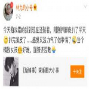 林允回应撕脚皮 大家都要拉屎擦屁股的